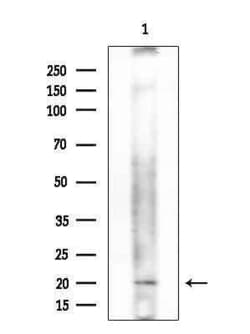 Invitrogen CD164 Polyclonal Antibody 100 &mu;L | Buy Online | Invitrogen&trade; | Fisher Scientific