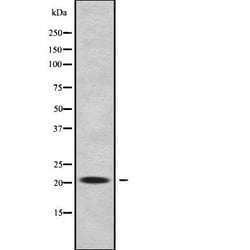 Invitrogen RABL5 Polyclonal Antibody 100 &mu;L; Unconjugated:Antibodies,