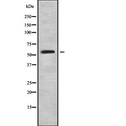 Invitrogen RFTN2 Polyclonal Antibody 100 &mu;L; Unconjugated:Antibodies,