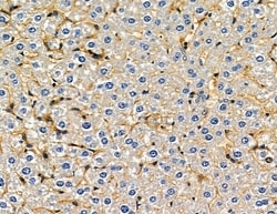 Invitrogen RGPD5 Polyclonal Antibody 100 &mu;L; Unconjugated:Antibodies,