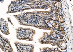 Invitrogen RASSF3 Polyclonal Antibody 100 &mu;L; Unconjugated:Antibodies,