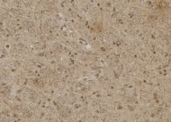 Invitrogen RASSF8 Polyclonal Antibody 100 &mu;L; Unconjugated:Antibodies,