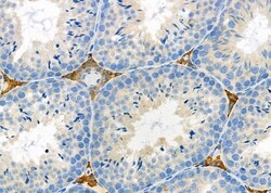 Invitrogen RASGEF1C Polyclonal Antibody 100 &mu;L; Unconjugated:Antibodies,