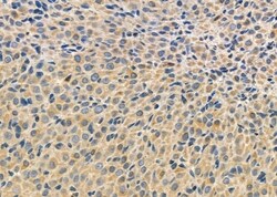 Invitrogen RASIP1 Polyclonal Antibody 100 &mu;L; Unconjugated:Antibodies,