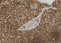 Invitrogen RERG Polyclonal Antibody 100 &mu;L; Unconjugated:Antibodies,