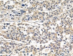 Invitrogen RERG Polyclonal Antibody 100 &mu;L; Unconjugated:Antibodies,