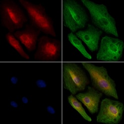 Invitrogen RAB15 Polyclonal Antibody 100 &mu;L; Unconjugated:Antibodies,