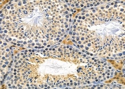 Invitrogen RAB15 Polyclonal Antibody 100 &mu;L; Unconjugated:Antibodies,