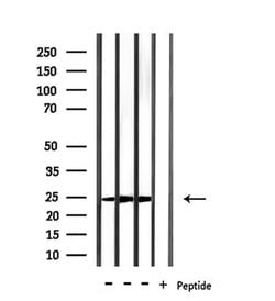 Invitrogen RAB15 Polyclonal Antibody 100 &mu;L; Unconjugated:Antibodies,