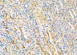 Invitrogen RAB1B Polyclonal Antibody 100 &mu;L; Unconjugated:Antibodies,