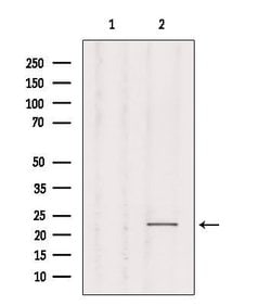 Invitrogen RAB1B Polyclonal Antibody 100 &mu;L; Unconjugated:Antibodies,