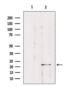 Invitrogen RAB1B Polyclonal Antibody 100 &mu;L; Unconjugated:Antibodies,