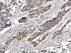 Invitrogen RAB21 Polyclonal Antibody 100 &mu;L | Buy Online | Invitrogen&trade; | Fisher Scientific