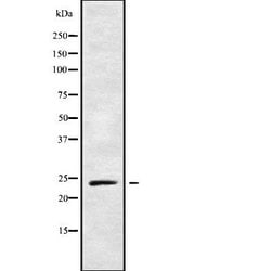 Invitrogen RAB21 Polyclonal Antibody 100 &mu;L | Buy Online | Invitrogen&trade; | Fisher Scientific
