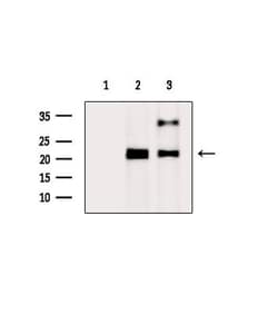 Invitrogen RAB22A Polyclonal Antibody 100 &mu;L | Buy Online | Invitrogen&trade; | Fisher Scientific