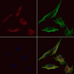 Invitrogen RAB24 Polyclonal Antibody 100 &mu;L; Unconjugated:Antibodies,