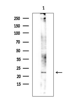 Invitrogen RAB24 Polyclonal Antibody 100 &mu;L; Unconjugated:Antibodies,