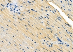 Invitrogen RAB28 Polyclonal Antibody 100 &mu;L; Unconjugated:Antibodies,