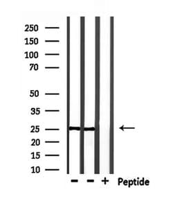 Invitrogen RAB28 Polyclonal Antibody 100 &mu;L; Unconjugated:Antibodies,