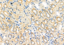Invitrogen RAB32 Polyclonal Antibody 100 &mu;L; Unconjugated:Antibodies,