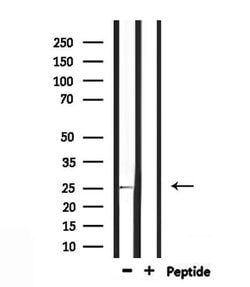 Invitrogen RAB32 Polyclonal Antibody 100 &mu;L; Unconjugated:Antibodies,