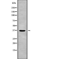 Invitrogen RAB36 Polyclonal Antibody 100 &mu;L; Unconjugated:Antibodies,