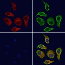 Invitrogen RAB39B Polyclonal Antibody 100 &mu;L; Unconjugated:Antibodies,