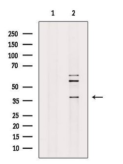 Invitrogen RAB39B Polyclonal Antibody 100 &mu;L; Unconjugated:Antibodies,
