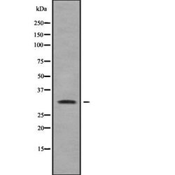 Invitrogen RAB40A Polyclonal Antibody 100 &mu;L; Unconjugated:Antibodies,