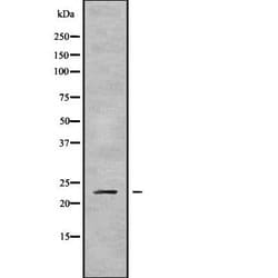 Invitrogen RAB43 Polyclonal Antibody 100 &mu;L; Unconjugated:Antibodies,