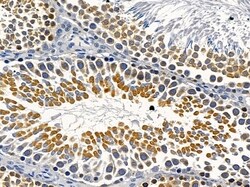 Invitrogen RAB5B Polyclonal Antibody 100 &mu;L; Unconjugated:Antibodies,