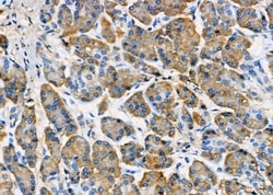 Invitrogen RAB8B Polyclonal Antibody 100 &mu;L | Buy Online | Invitrogen&trade; | Fisher Scientific