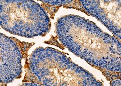 Invitrogen RAB8B Polyclonal Antibody 100 &mu;L | Buy Online | Invitrogen&trade; | Fisher Scientific