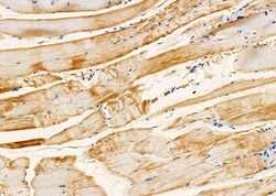 Invitrogen RAB8B Polyclonal Antibody 100 &mu;L | Buy Online | Invitrogen&trade; | Fisher Scientific