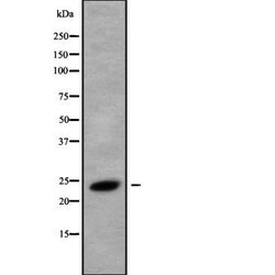 Invitrogen RAB8B Polyclonal Antibody 100 &mu;L | Buy Online | Invitrogen&trade; | Fisher Scientific