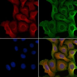 Invitrogen RAB9B Polyclonal Antibody 100 &mu;L | Buy Online | Invitrogen&trade; | Fisher Scientific