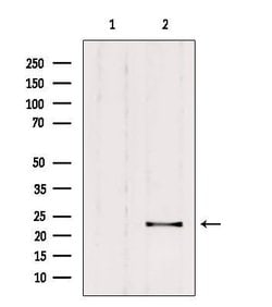 Invitrogen RAB9B Polyclonal Antibody 100 &mu;L | Buy Online | Invitrogen&trade; | Fisher Scientific