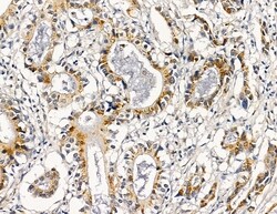 Invitrogen RRAS2 Polyclonal Antibody 100 &mu;L | Buy Online | Invitrogen&trade; | Fisher Scientific