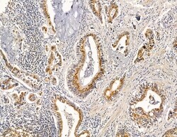 Invitrogen RRAS2 Polyclonal Antibody 100 &mu;L | Buy Online | Invitrogen&trade; | Fisher Scientific