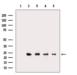 Invitrogen RRAS2 Polyclonal Antibody 100 &mu;L | Buy Online | Invitrogen&trade; | Fisher Scientific