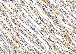 Invitrogen PTPRK Polyclonal Antibody 100 &mu;L; Unconjugated:Antibodies,