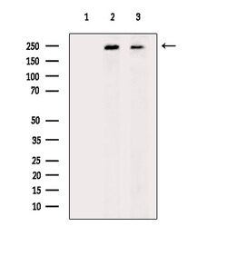 Invitrogen PTPRK Polyclonal Antibody 100 &mu;L; Unconjugated:Antibodies,