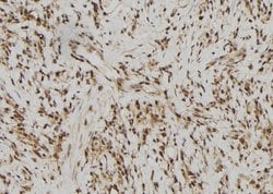Invitrogen RFPL2 Polyclonal Antibody 100 &mu;L; Unconjugated:Antibodies,