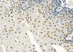Invitrogen RFPL2 Polyclonal Antibody 100 &mu;L; Unconjugated:Antibodies,