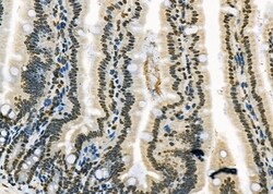 Invitrogen RFPL2 Polyclonal Antibody 100 &mu;L; Unconjugated:Antibodies,