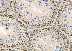 Invitrogen RFPL2 Polyclonal Antibody 100 &mu;L; Unconjugated:Antibodies,