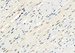 Invitrogen RFPL2 Polyclonal Antibody 100 &mu;L; Unconjugated:Antibodies,