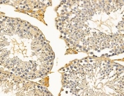 Invitrogen RBBP6 Polyclonal Antibody 100 &mu;L; Unconjugated:Antibodies,