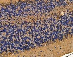 Invitrogen ARHGAP20 Polyclonal Antibody 100 &mu;L; Unconjugated:Antibodies,