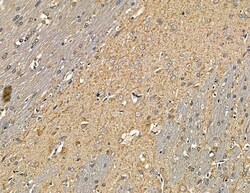 Invitrogen ARHGAP20 Polyclonal Antibody 100 &mu;L; Unconjugated:Antibodies,